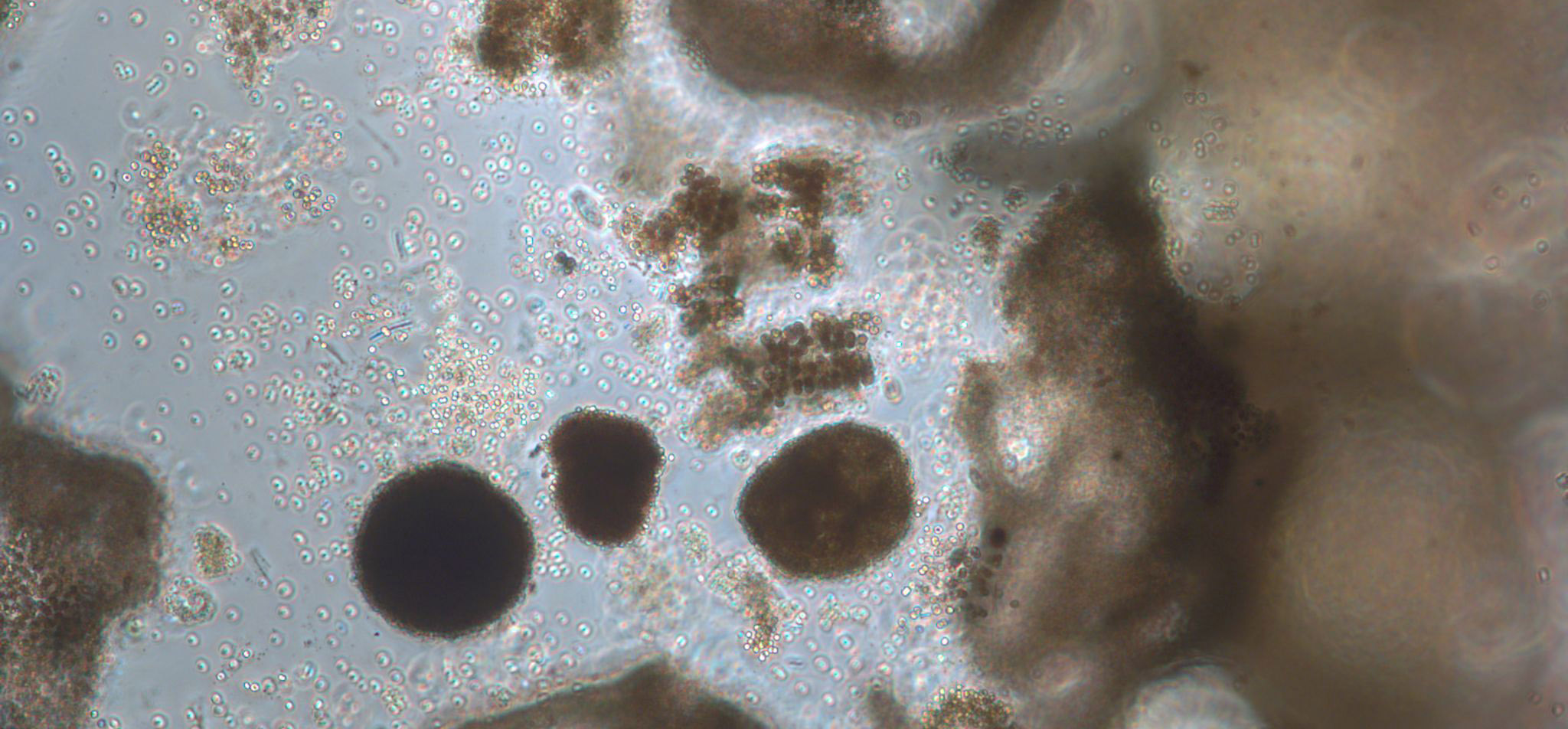 mikroskopbild på algblomning av cyanobakterier.