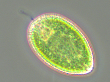 närbild på plankton gonyostomum