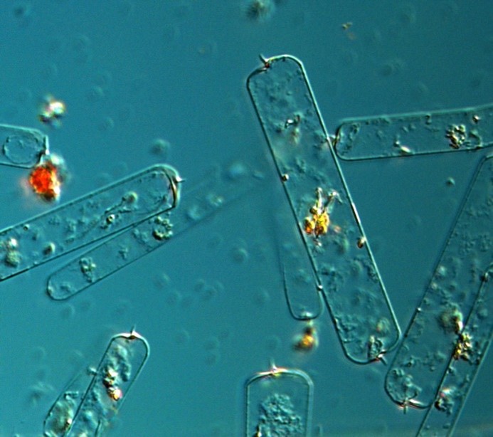 Kiselalgen Dactyliosolen fragilissimus