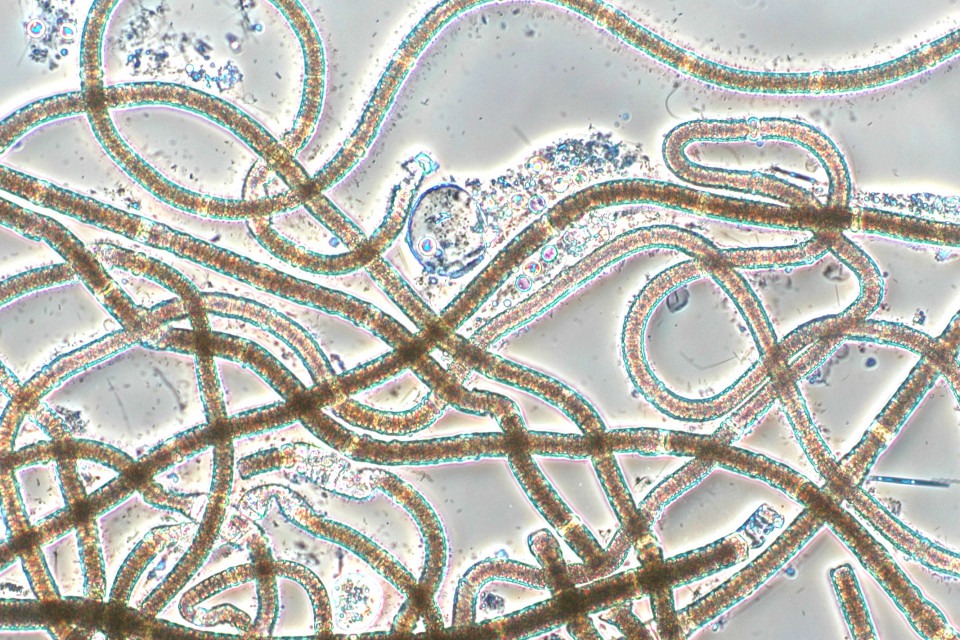 Cyanobakterie Nodularia spumigena