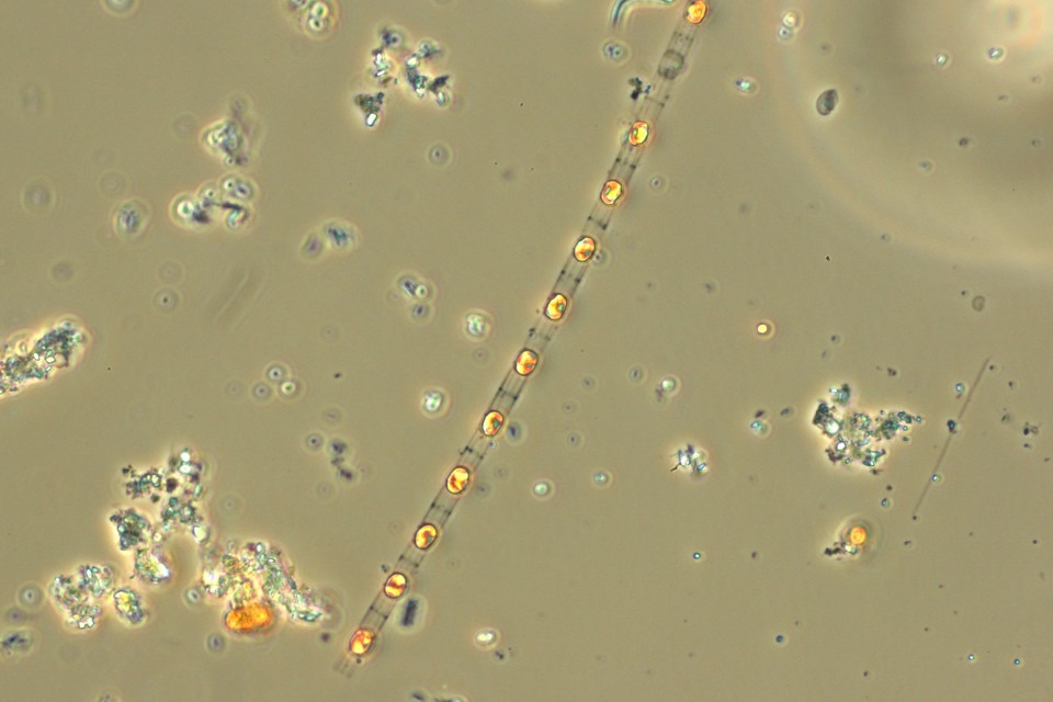 Kiselalg Skeletonema costatum