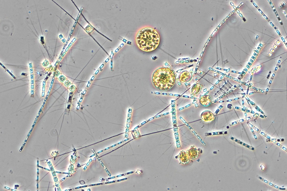 Mikroskopbild av vårblomning i Bottenhavet