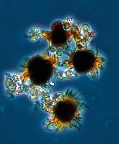 Mesodinium rubrum är en vanlig ciliatart som förekommer i hela Östersjön. Foto: Helena Höglander