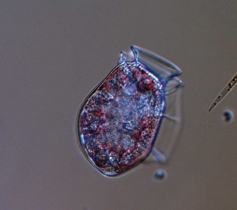 Den potentiellt giftiga dinoflagellaten Dinophysis acuta förekommer längs hela Västkusten. Den brukar finnas i störst mängd under sensommar till höst. Foto: Ann-Turi Skjevik
