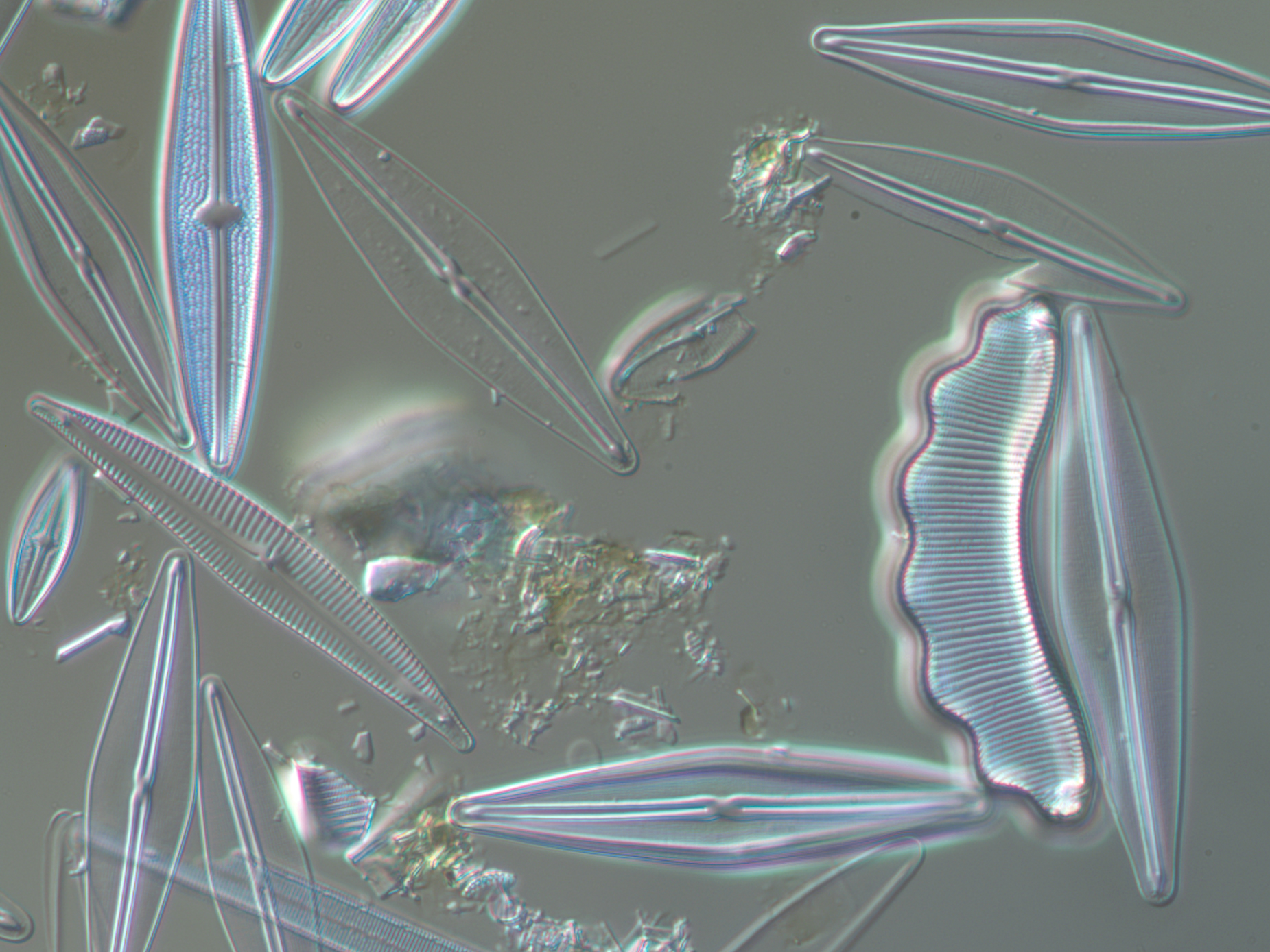 Kiselalger i välkommatjärn. Mikroskopbild.